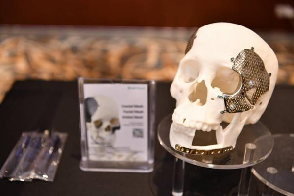 กระดูกไทเทเนียม